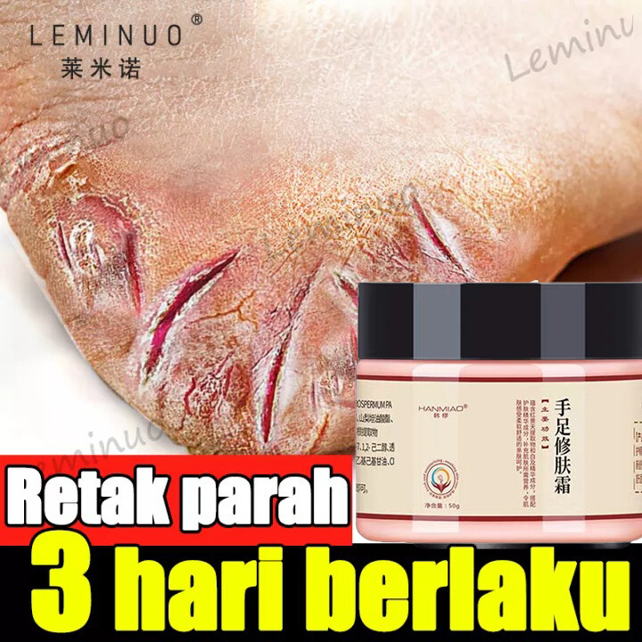 Gambar Hand Foot Anti cracking Cream50g Anti Drying Crack Foot Cream Heel Cracked Repair Cream Removal Dead Skin Hand Feet Care
