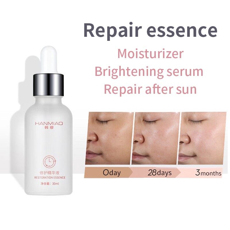 Gambar Repair Facial Essence 30ml Moisturizing After Sun Repair Sensitive Red Blood Aloe Vera Essence