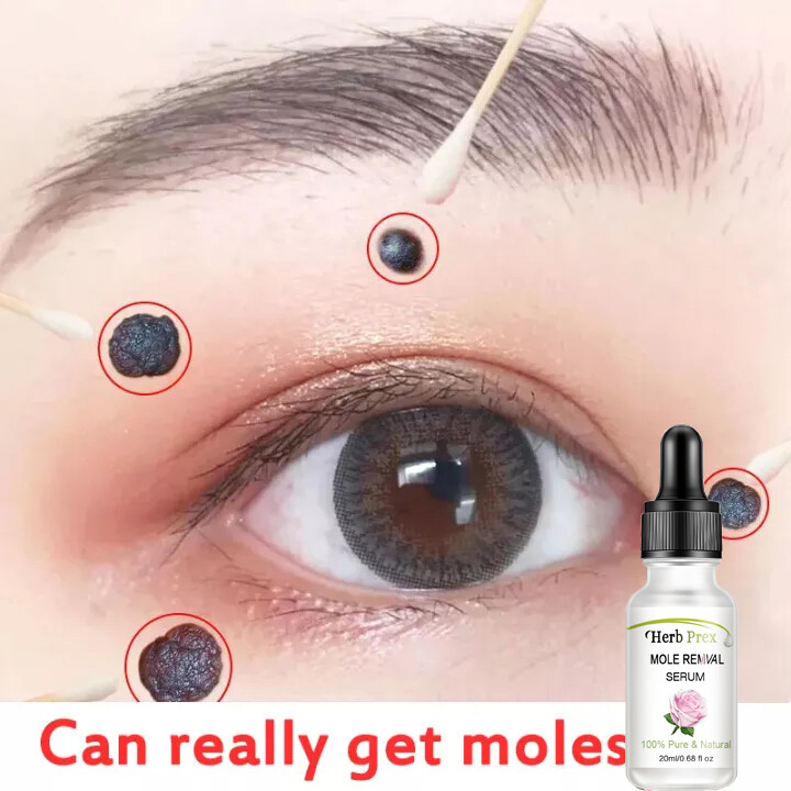Gambar ?Shipped in Malaysia?JinChen Beauty Store Facial Essential Oil 20ml Vitamin E Oil Whitening Freckle Mole Remover Lighten Melanin Dark Spot Serum