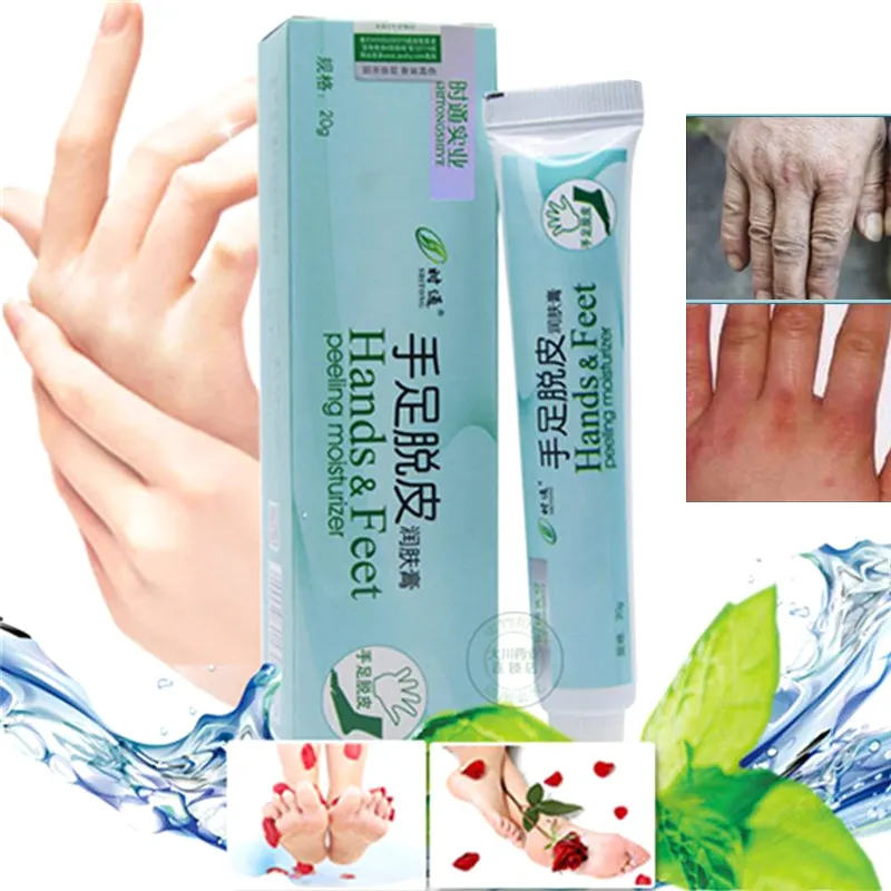 cream for peeling hands