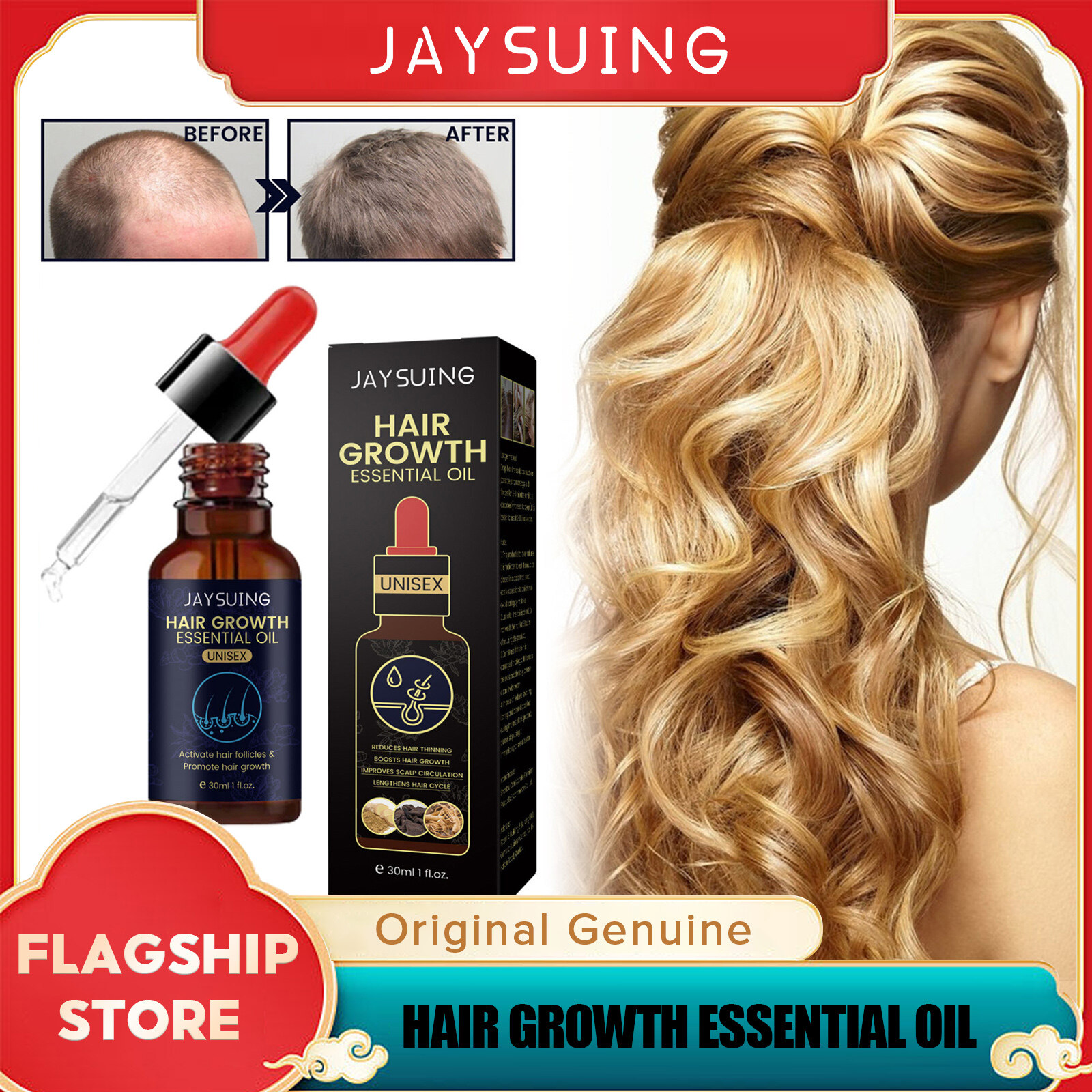 Jaysuing Hair Growth Essential Oil Natural Ginger Ginseng Extract Fast Growing Hair Essential Oil Beauty Hair Care Prevent Hair Loss Oil Scalp Treatment Hair Smooth Nourish Hair Growth Replenish For Men Women Hair Serum 30ml Harga 14 Ringgit*Penghantaran Percuma