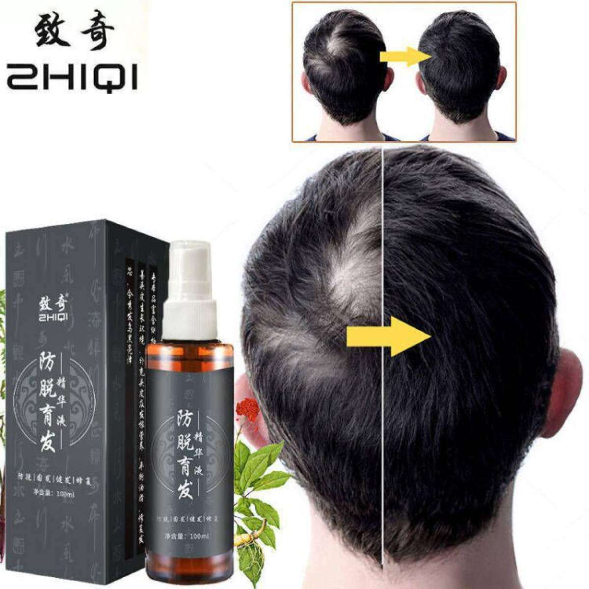 Gambar ?Malaysia Stock?Fast Hair Growth Serum Spray Gingseng Essence Hair Growth Tonic Prevent Hair Loss Serum Improve Hair Follicles Nourishing Hair Root Hair Fall Treatment Spray Men   Women Hair Tonic with Herbal Essence 100ml