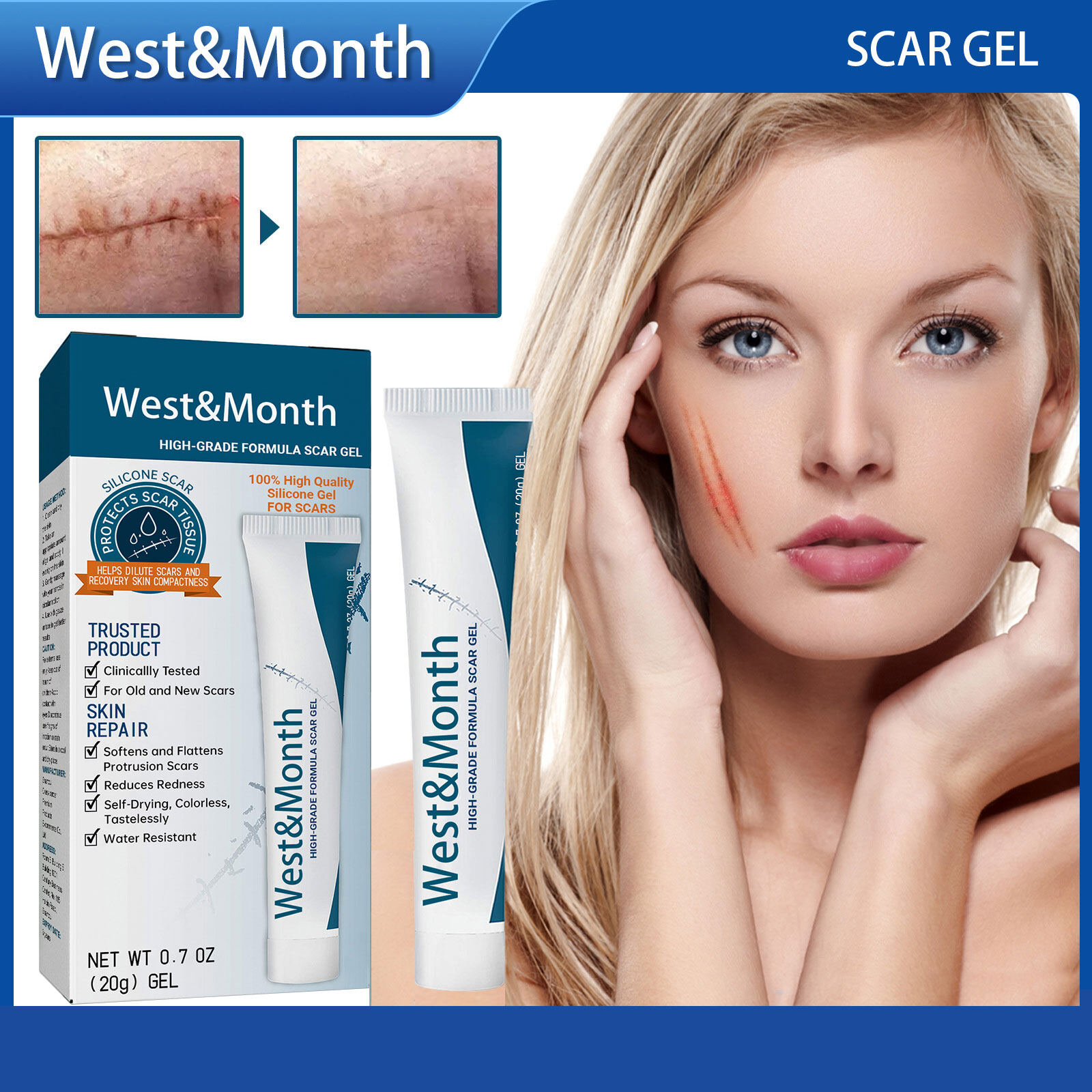  Tháng Tây Cao Cấp Công Thức Gel trị sẹo Chất Lượng Cao gel silicon Cho Vết Sẹo Sửa Chữa làm mịn da Sẹo Chăm Sóc Gel Làm Mịn Làm Săn Da Thắt Chặt Bỏng Phẫu Thuật Sẹo Sẹo rạn da Kem điều trị làn da mịn màng sản phẩm chăm sóc 