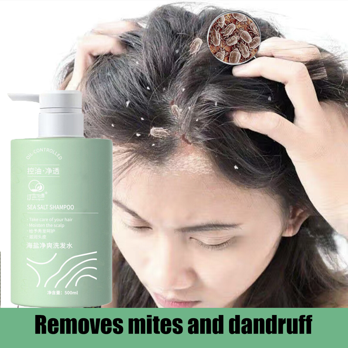 Gambar ?Special Price?Anti Dandruff Shampoo500ml remove mites refreshing oil controlling  deep cleansing of the scalp folliculitis repair cleansing scalp  anti dandruff and anti itch shampoo