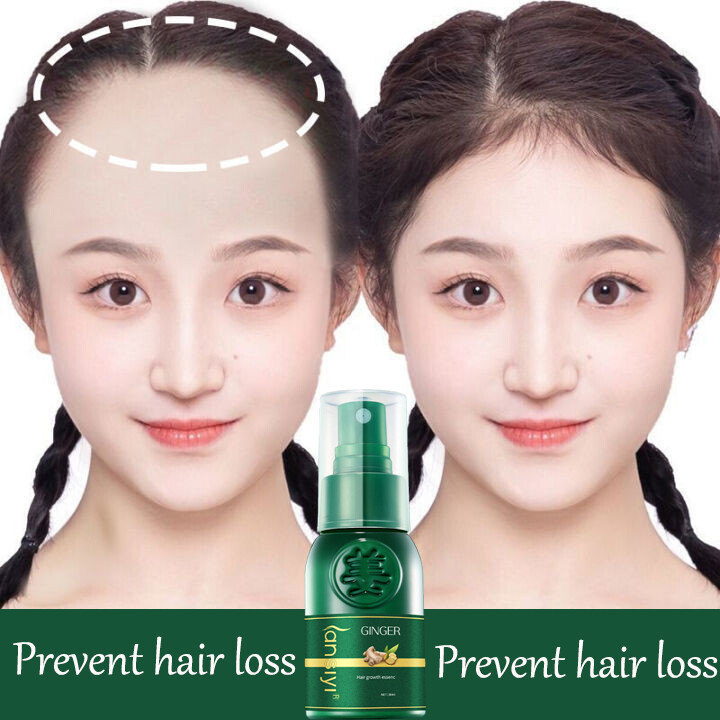 Gambar ?Same day delivery?100% original Prevent hair loss for men and women Natural hair growth hair tonic for hair growth  hair care treatment Dandruff  Dryness  Thinning Volumizing Frizziness  Hydrating  Prevent hair loss spray 30ml