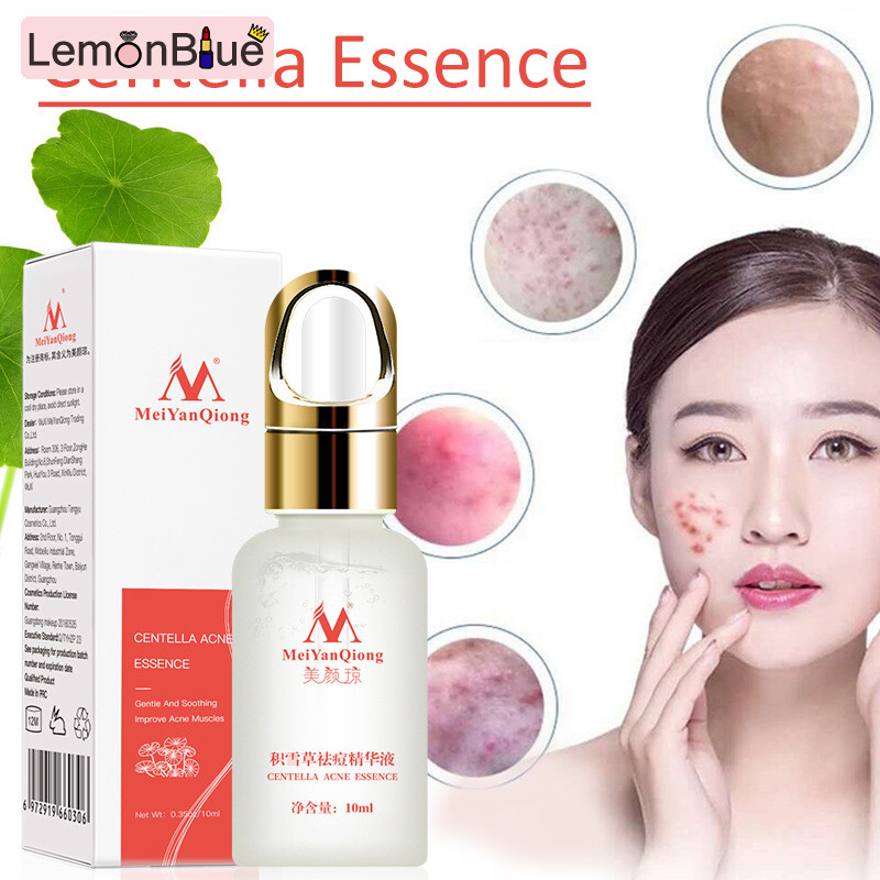 Gambar LemonBlue Centella Asiatica Acne Removing Essence Serums To Eliminate Marks   Improve Smooth Skin Oil Control Serums Centella Asiatica To Eliminate Marks   Improve Pox Muscle Acne Removing Essence Serums