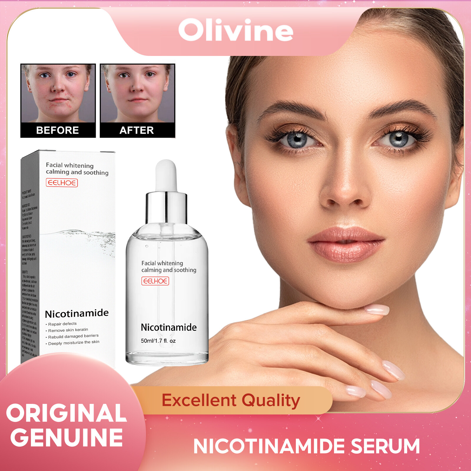  Eelhoe nicotinamide chất đắp mặt vết thâm làm trắng mụn nhọn Mụn trứng cá điều trị se khít lỗ chân lông giữ ẩm niacinamide serum axit hyaluronic nicotinamide chất đắp mặt bổ sung dưỡng ẩm dưỡng ẩm thu nhỏ lỗ chân lông làm sáng da chăm sóc tinh chất làm să 