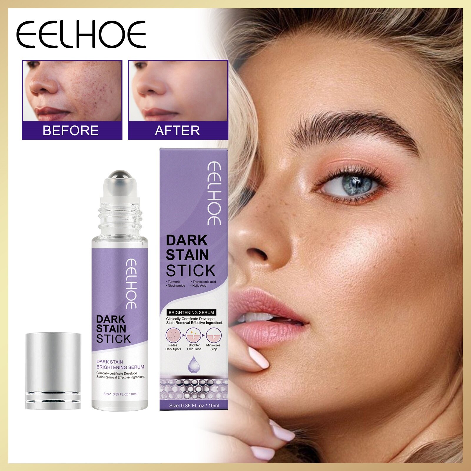 Eelhoe Whitening Dark Spot Essence Roller Remover Dark Spot Repair Lightening Skin Blemish Melasma Melanin Hydrating Black Spot Moisturizing Skin Whitening Freckle Essence Harga 14 Ringgit*Penghantaran Percuma