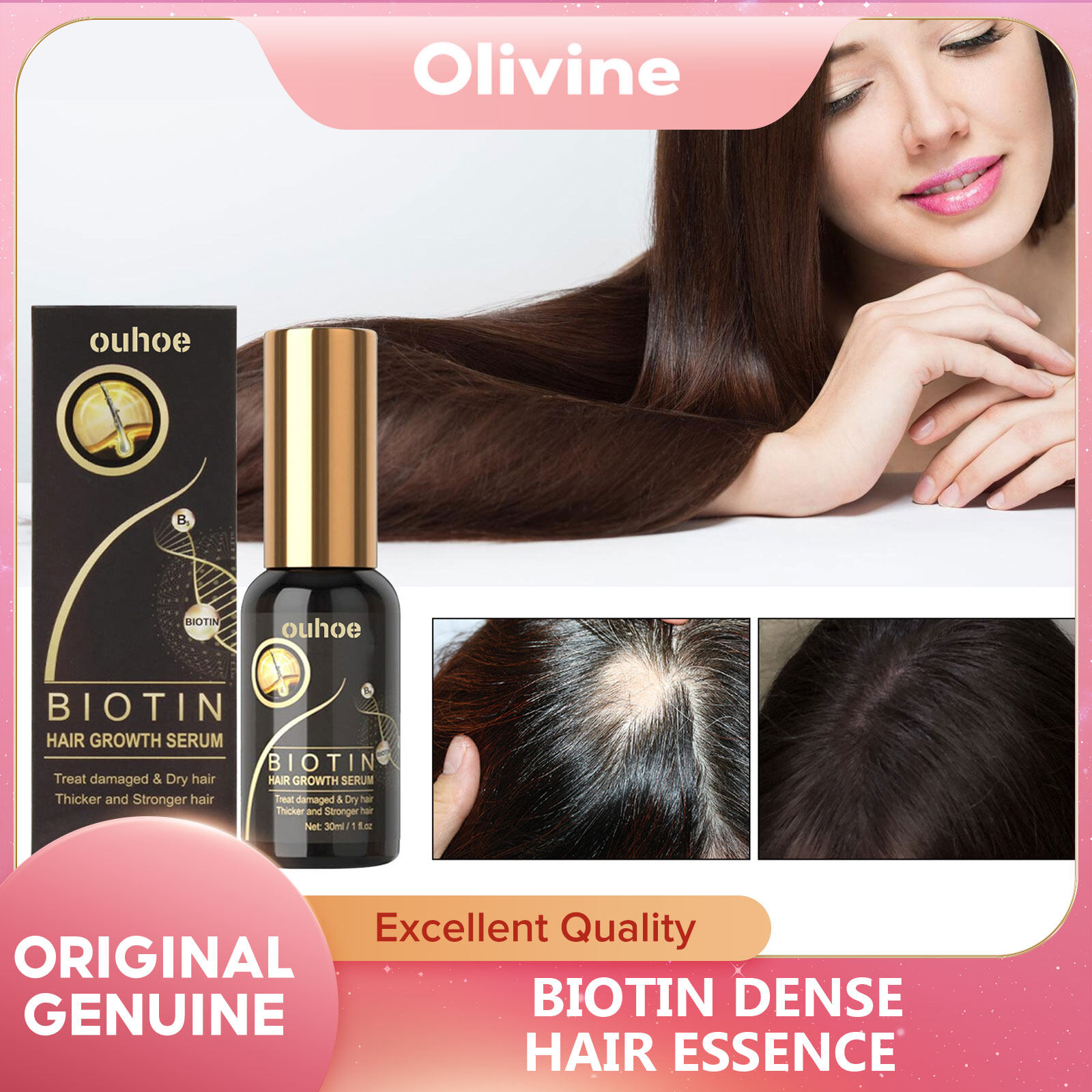 Ouhoe biotin tinh chất tóc dày đặc phục hồi tinh dầu sửa chữa tóc hư tổn phục hồi chống rụng tóc điều trị dày đặc nuôi dưỡng giải pháp chăm sóc tóc tóc mượt tinh dầu s mọc tóc bản chất ban đầu giảm tóc thật chất lỏng khỏe mạnh làm đẹp