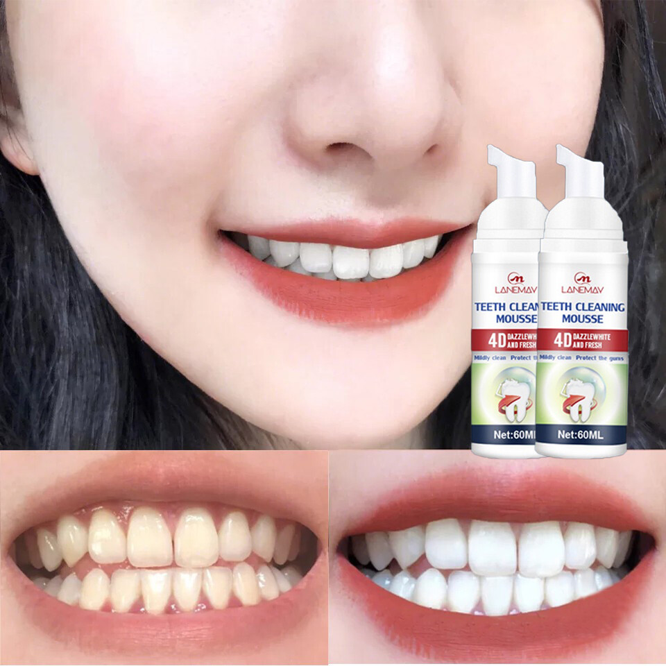 Gambar Teeth Mousse 60ml Foam Deep Cleaning Teeth Whitening Mousse Stain Removal Refreshing Dispel Yellow Eliminate Bad Breath