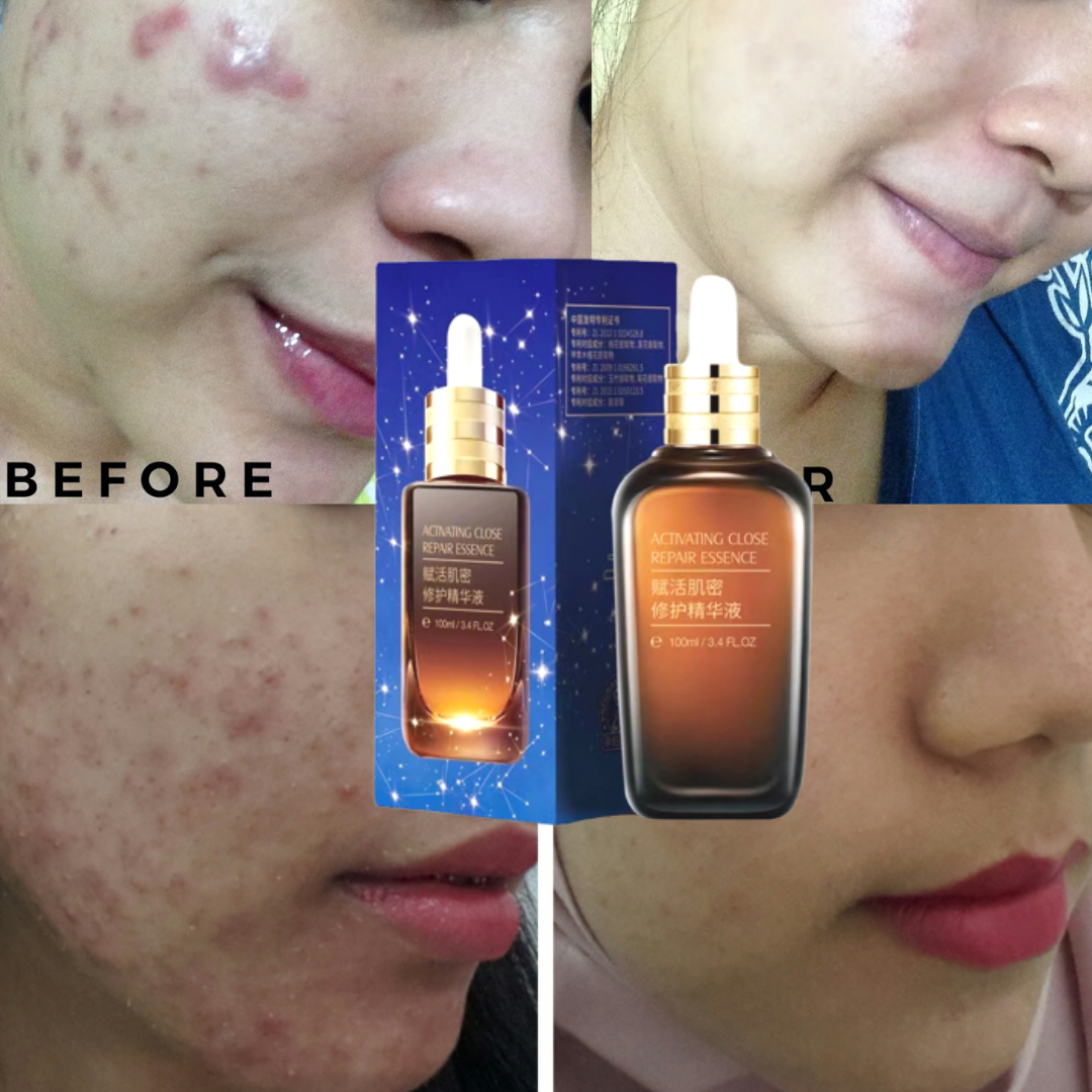 Gambar [Original] 100ml Advanced Night Repair Serum Face Serum Natural Anti Aging Skin Care Facial Serum Smooth Tighten Brighten Whitening Skin