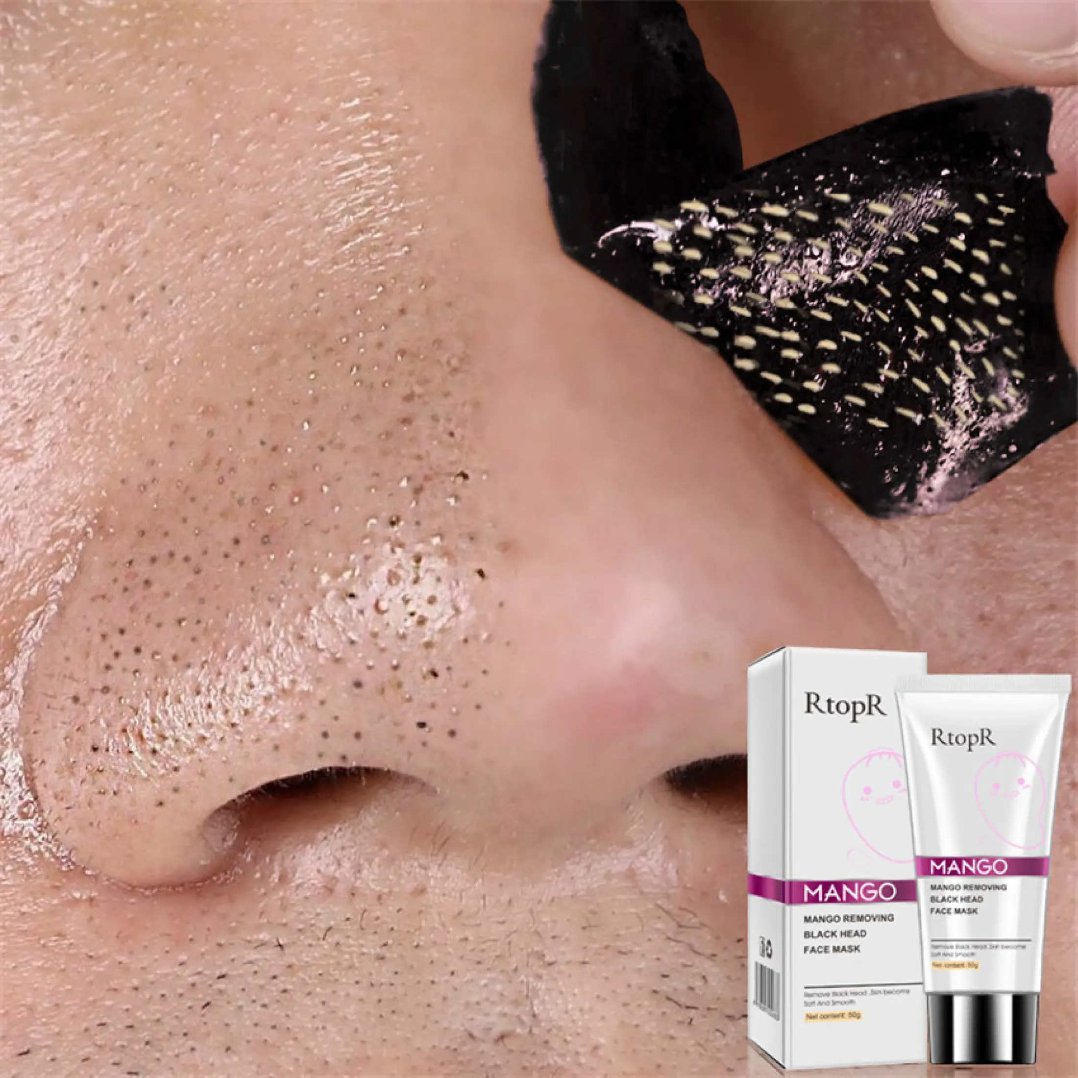 cream to remove dark spots on nose