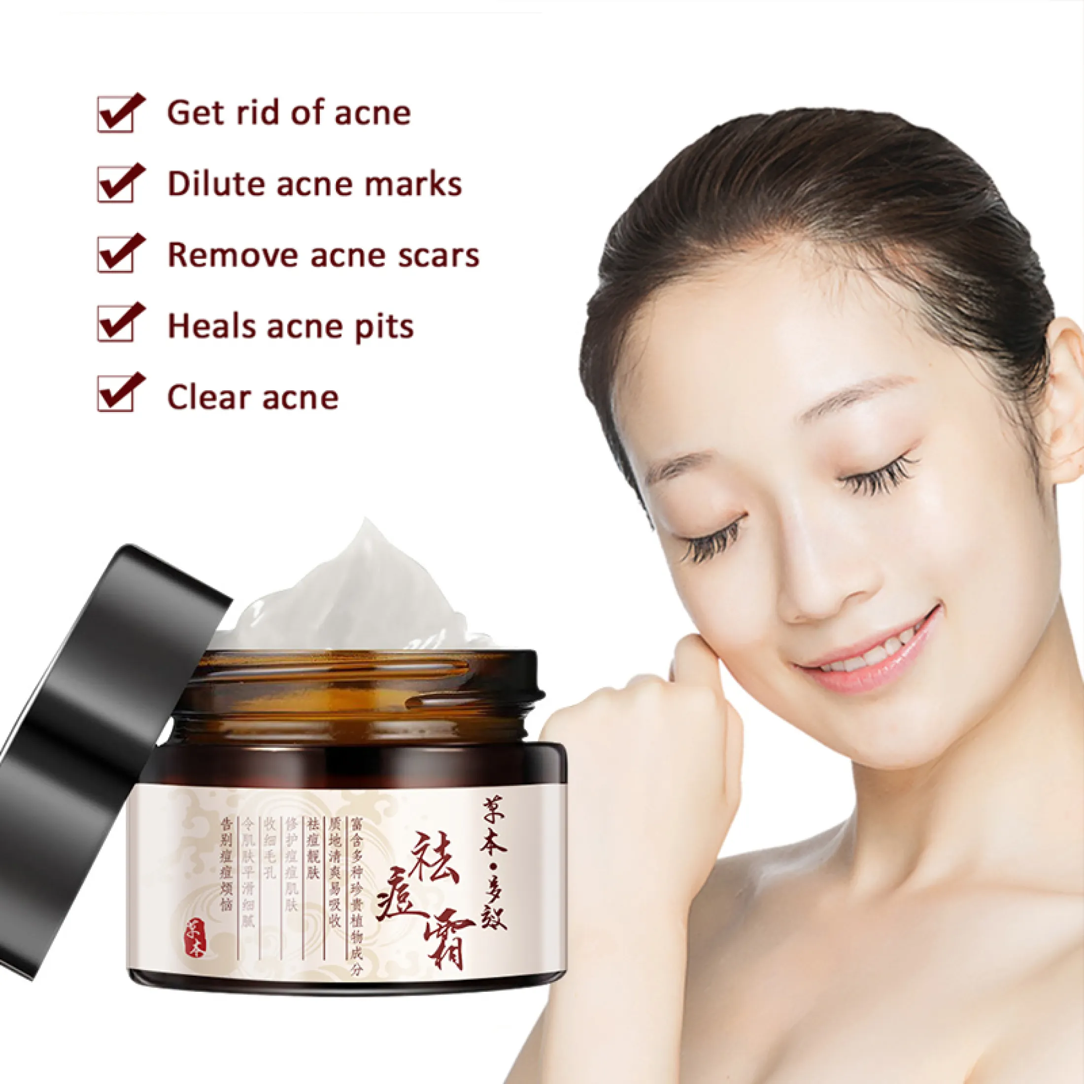 pimple and blackhead remover cream