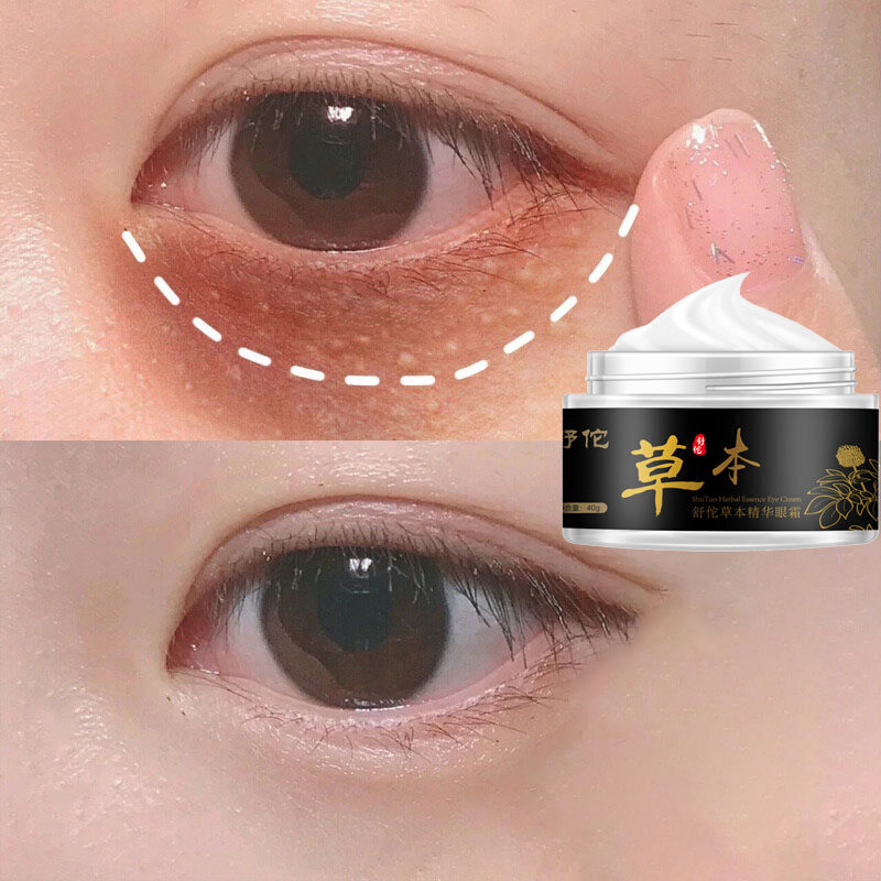 Gambar Fades fine lines repairs  moisturizes removes dark circles bags under the eyes and fat particles lifts and tightens men s and women s anti wrinkle artifacts eye contours herbal essence eye cream 40g