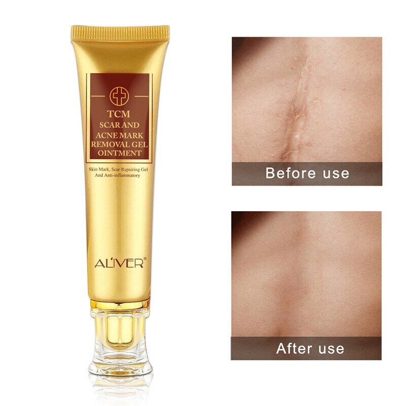 stretch mark and scar cream