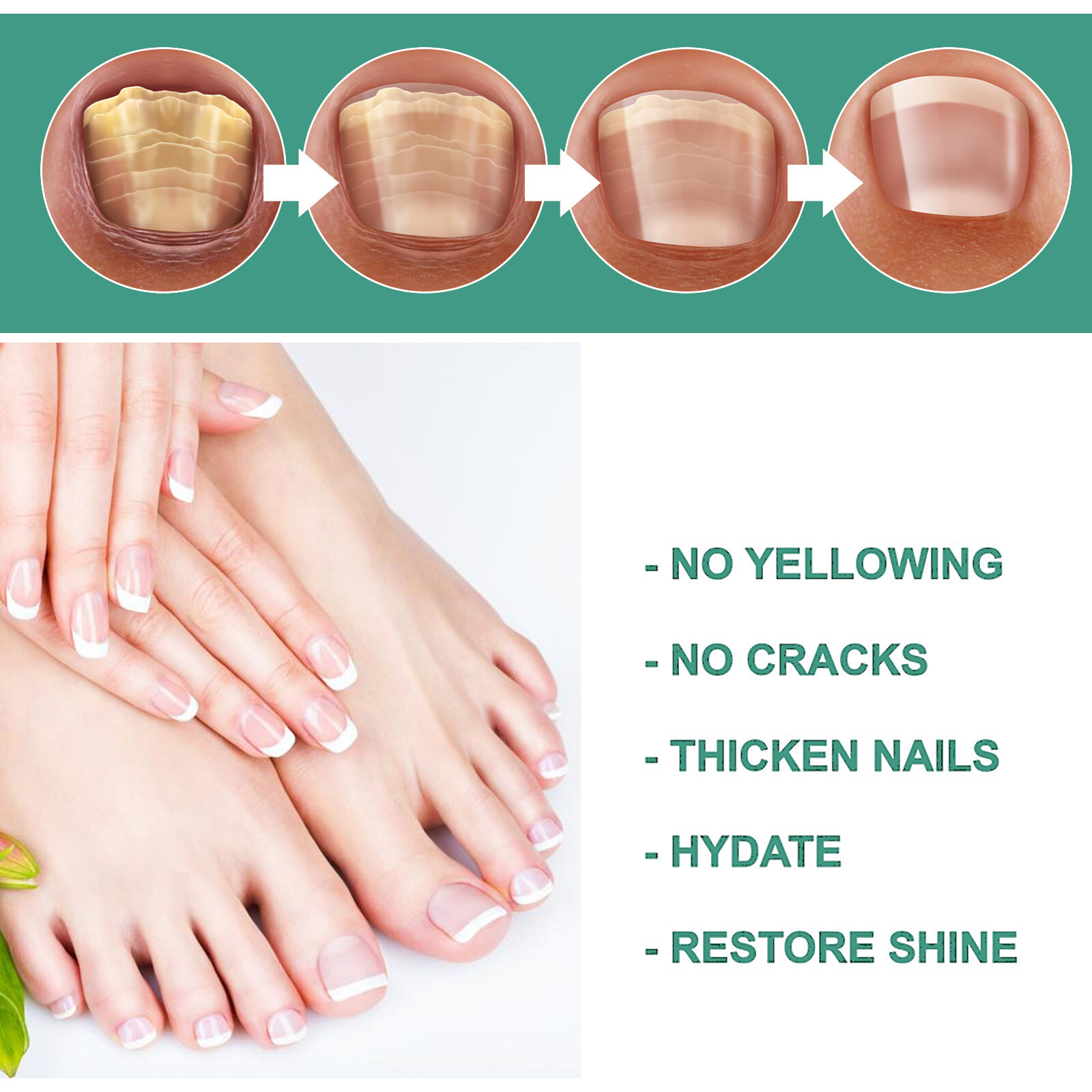 Herbal Nails Repairing Serum Paronychia Onychomycosis Treatment Anti ...