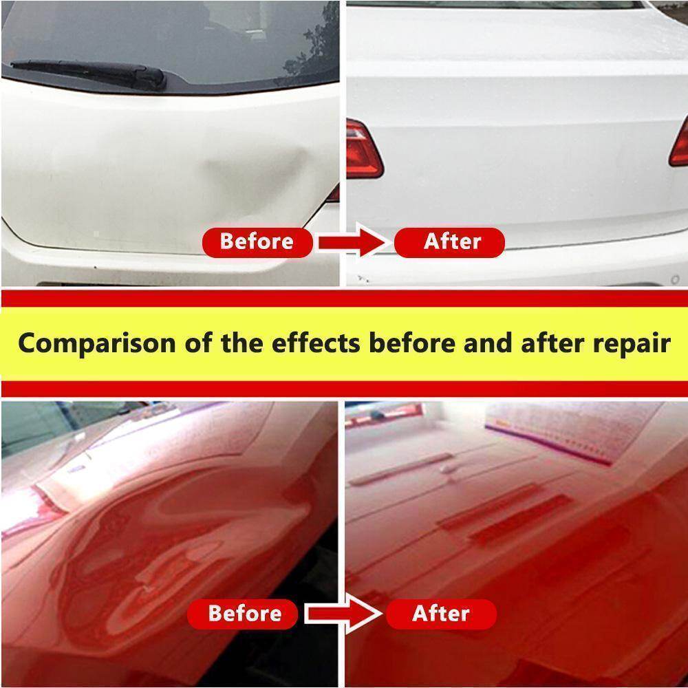 Best Dent Removal Kit 2023 Top Best Dent Removal Kit
