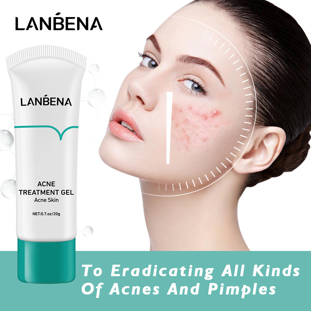 Gambar Acne Facial Cleanser, Acne Cream, Acne Essence, Deep Cleansing, Gentle Cleansing, No Tightness, Lightening Acne Marks, Acne Marks, Acne and Oil Control, For Men and Women, Whole Body 20g