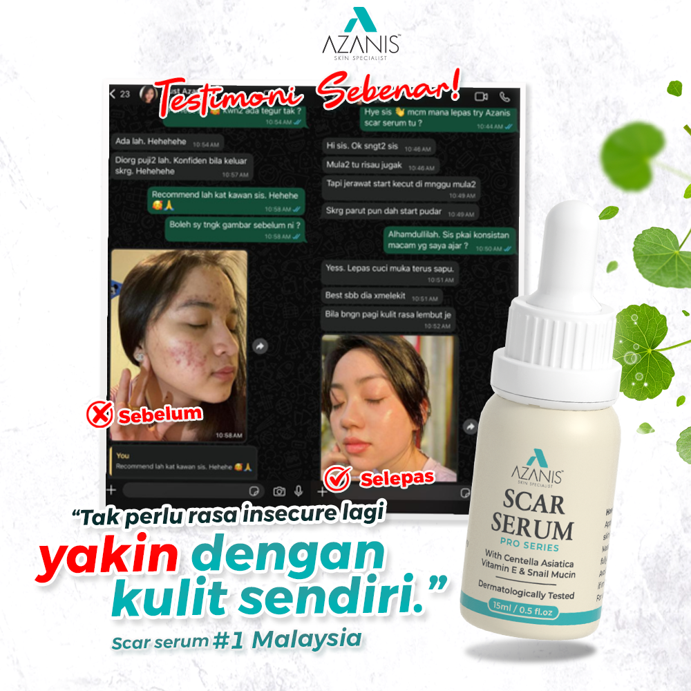 READY STOCK) ARK drops Malaysia Ready Stock Ark Drops Default Tax