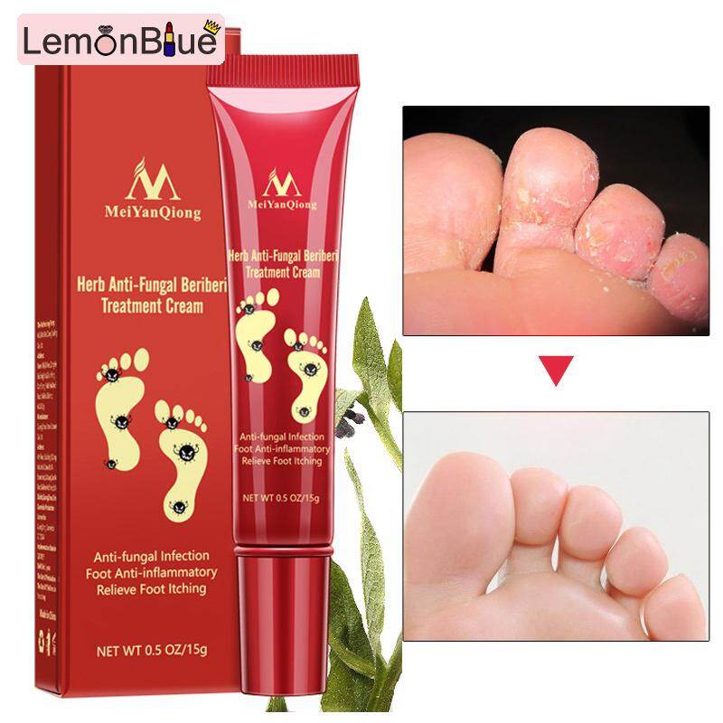 Gambar LemonBlue Natural Nail Protector Skin Care Cream Nail Fungus Treatment Herb Antifungal Ointment 15g