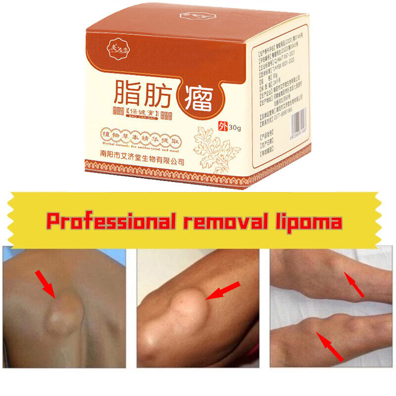Gambar 99 cure lipoma removal cream to remove subc 99 Menyembuhkan Tumor Lemak, Keluarkan Krim, Mengelupas, Krim Lemak Berbilang Rambut, Ketulan Keras