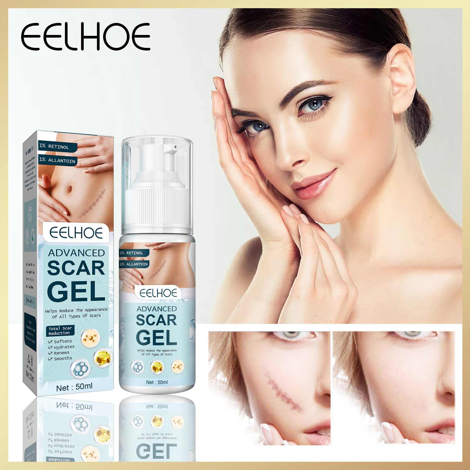  Eelhoe Gel Trị Sẹo Cao Cấp Kem Trị Sẹo Mụn Hiệu Quả Gel Mặt Dưỡng Ẩm Làm Trắng Xóa Vết Rạn Da Làm Mịn Vết Rạn Da Vết Bỏng Cơ Thể Vết Thương Phẫu Thuật Sẹo Thúc Đẩy Điều Trị Tái Tạo Tế Bào  50Ml  