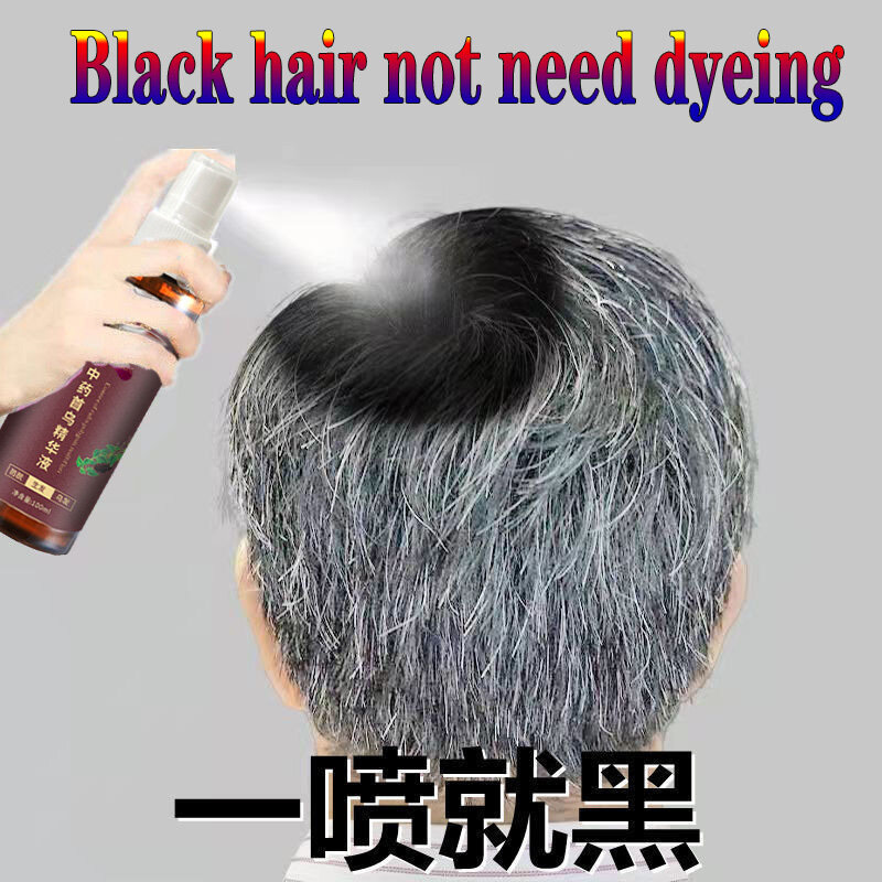 Gambar White hair to black hair Prevent hair Hair Growth Essence Hair Loss Dry Frizz Speed up Hair Growth Hair Care Anti hair Loss Shampoo Suitable for low hair volume Hair Treatment  Damaged Hair Split ends Anti fungal 100 ml for men and women
