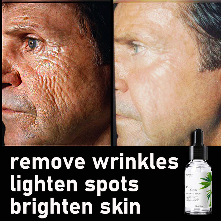 Gambar Facial Serum Anti wrinkle Essence Freckle cream Whitening face Moisturizing Anti freckle wrinkle Anti aging skincare jeragatm Facial care????