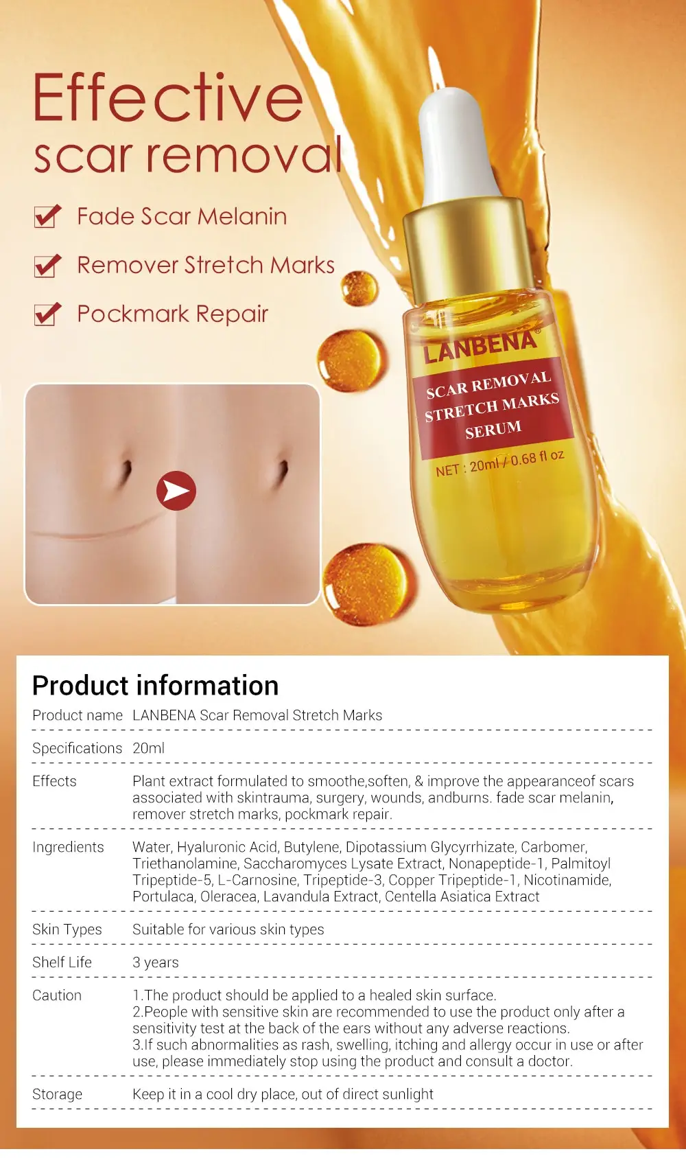 gold bond stretch mark cream
