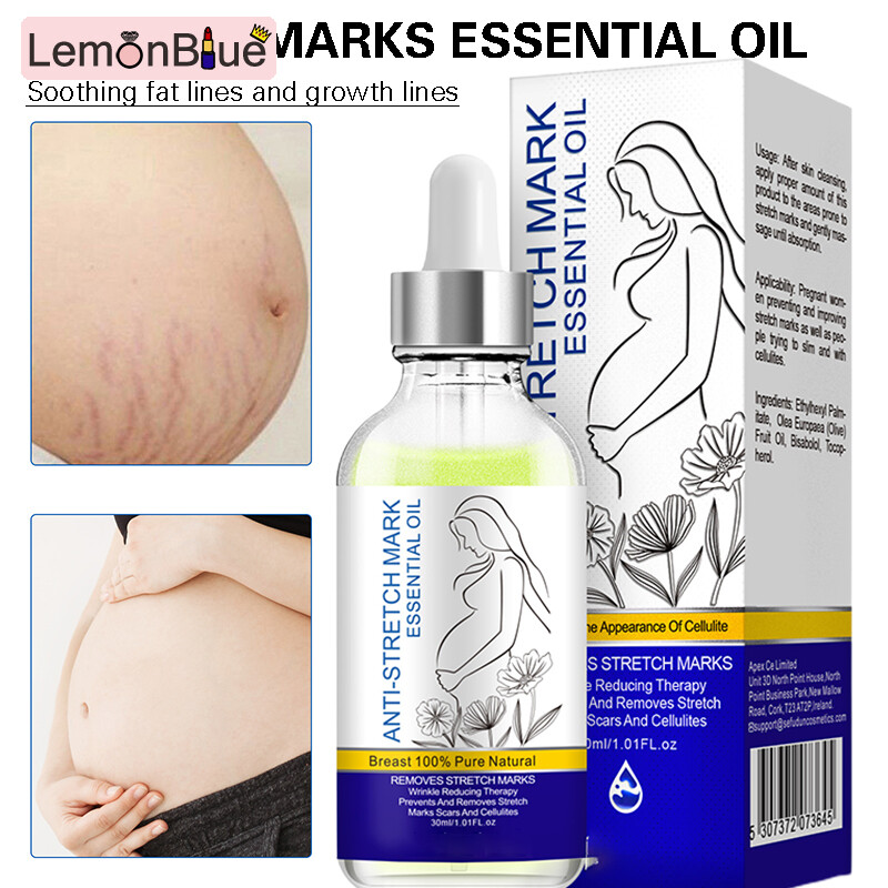Gambar LemonBlue 30ML Stretch Mark Essential Oil Smoothing Repair Stretch Marks Removal Liquid Women Smoothing Repair Stretch Marks Removal Liquid Professional Skin Care Supplies Easy to Use Stretch Mark Essential Oil