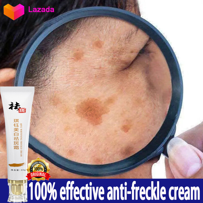 Gambar ?Local Seller?Whitening Anti Freckle Cream 100% effectively removes melasm freckles age spots Freckles marks Black spots Acne Spots Black marks  Whitening cream 30 g  Herbal Freckle cream Moisturizing Black Red acne marks