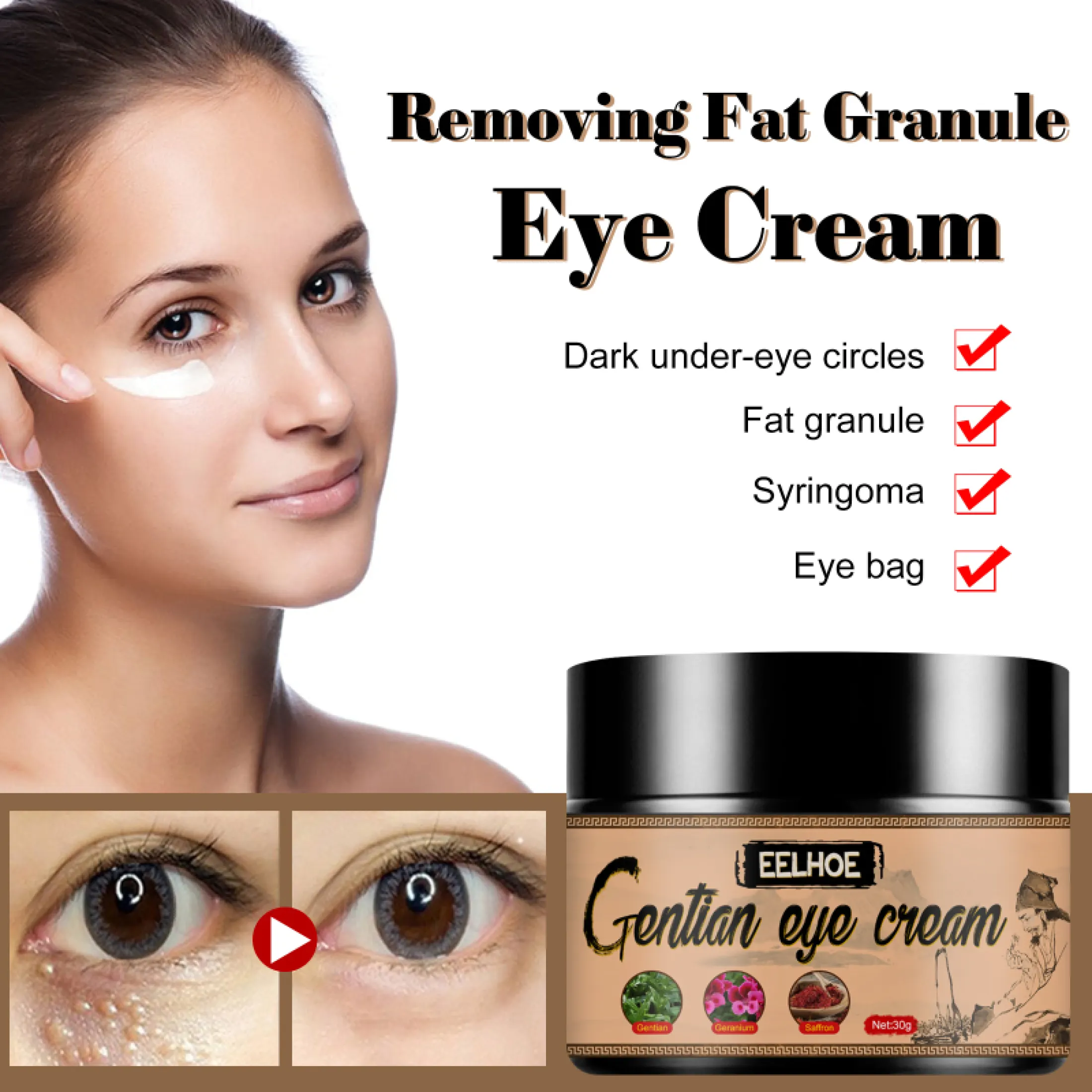 cream to remove bags under eyes