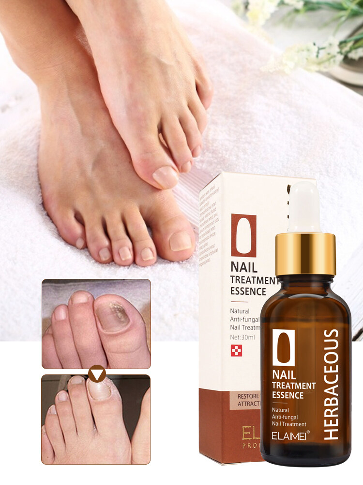 Anti Fungal Nail Gel Fungal Nails Treatment Serum Hand Foot Cream Repair Toenail Remove