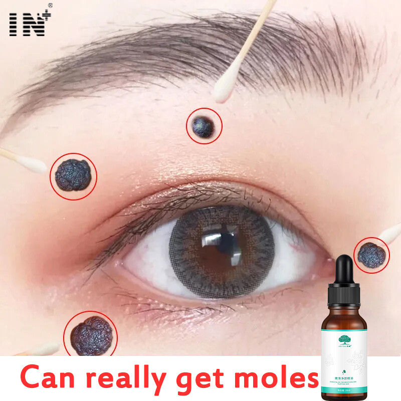 Gambar Mole Remover Facial Essential Oil 20ml Vitamin E Serum Lighten Melanin Remove Dark Spot Whitening Fading Tattoos Markings Serum