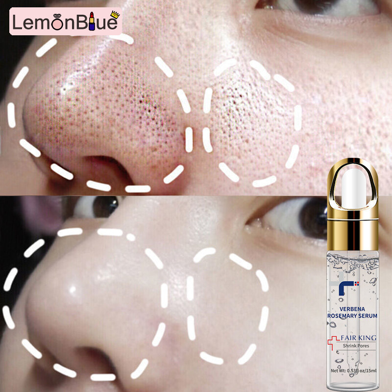 Gambar LemonBlue FAIR KING Verbena Rosemary Face Serum Anti Aging Anti Wrinkle Essence Whitening Moisturizing Exfoliating Shrink Pores Fade Fine Lines Care  Wajah Glowing Pemutih Mengecilkan Pori Anti Penuaan Pelembab Wajah Esensi Perawatan Kulit Kering