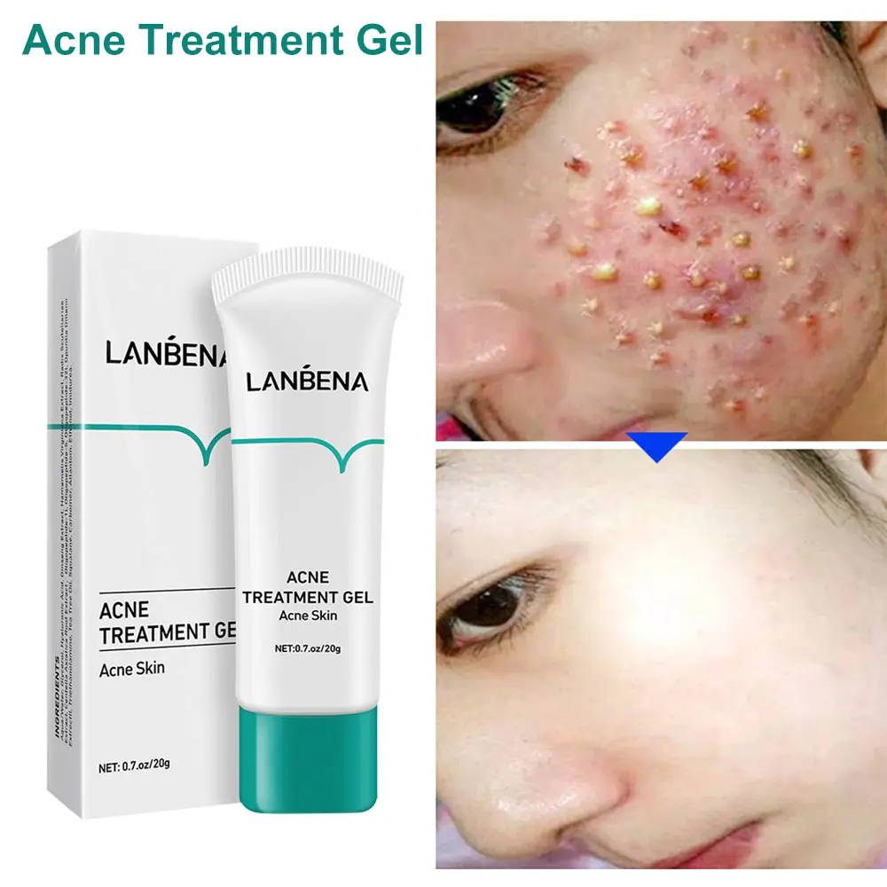 clean face gel cream