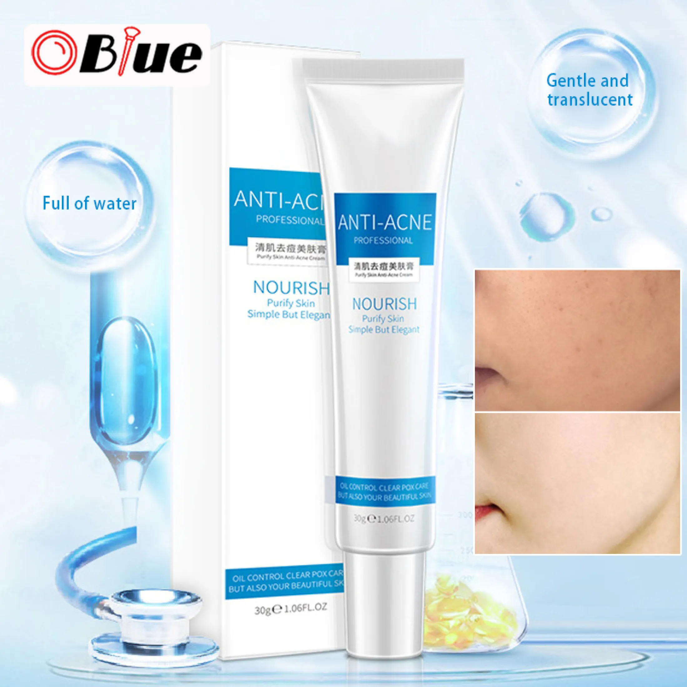 blemishes cream treatment