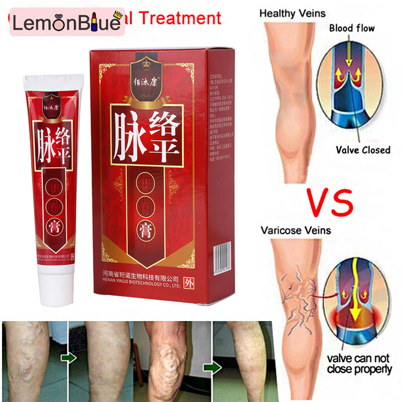 Gambar LemonBlue Varicose Veins Cream Leg Acid Relief Paste Vessel Health Skin Phlebitis Care