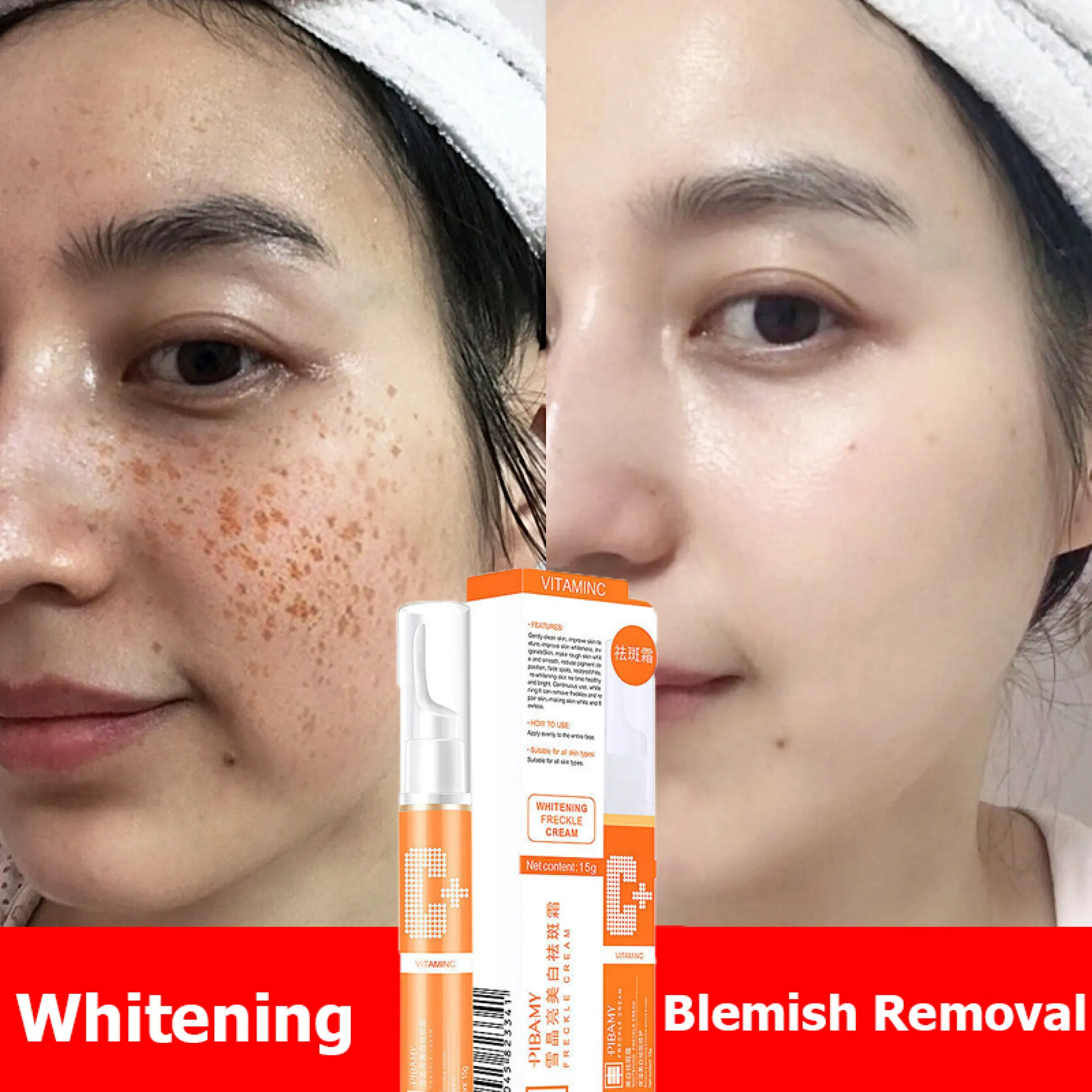 freckles treatment cream