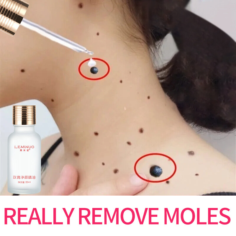 Gambar Rose essential oil 20ml lightens melanin removes moles brightens skin