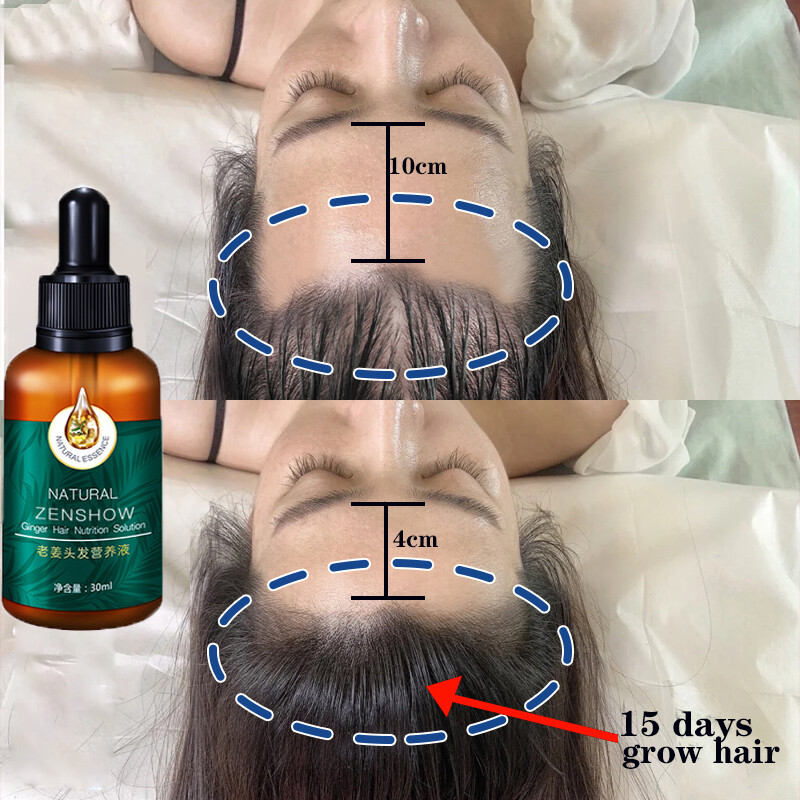 Gambar 100% effective Hair Growth Essence Oil nourishing hair care essence oil  Growth Strengthen hair roots to prevent hair loss Fast and powerful hair growth Repair damaged hair Eyebrow growth beard growth Prevent hair loss 30g