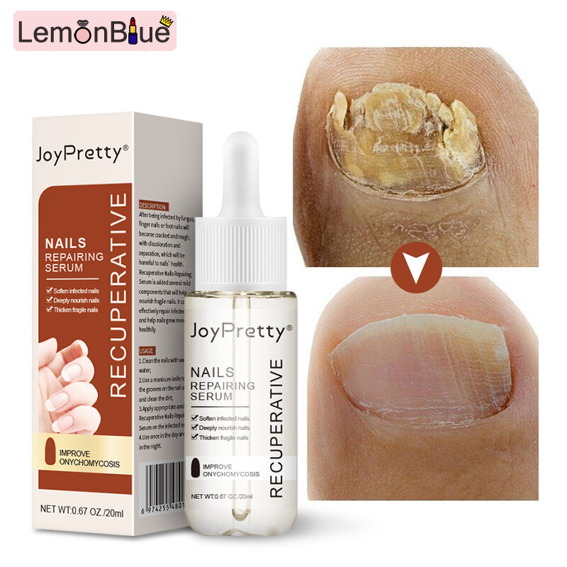 Gambar LemonBlue nail Exfoliating Serum