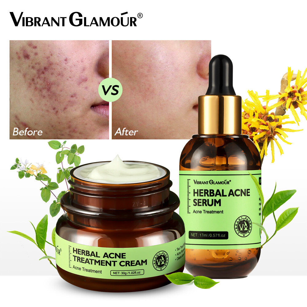 Gambar VIBRANT GLAMOUR Herbal Acne Removal Set Anti Acne Clear Pimples Facial Serum Tea Tree Oil Acne Removal Facial Cream Firming Acne Serum Gentle Quick Remove Acne Marks Pimples Skin Care 2 Pieces