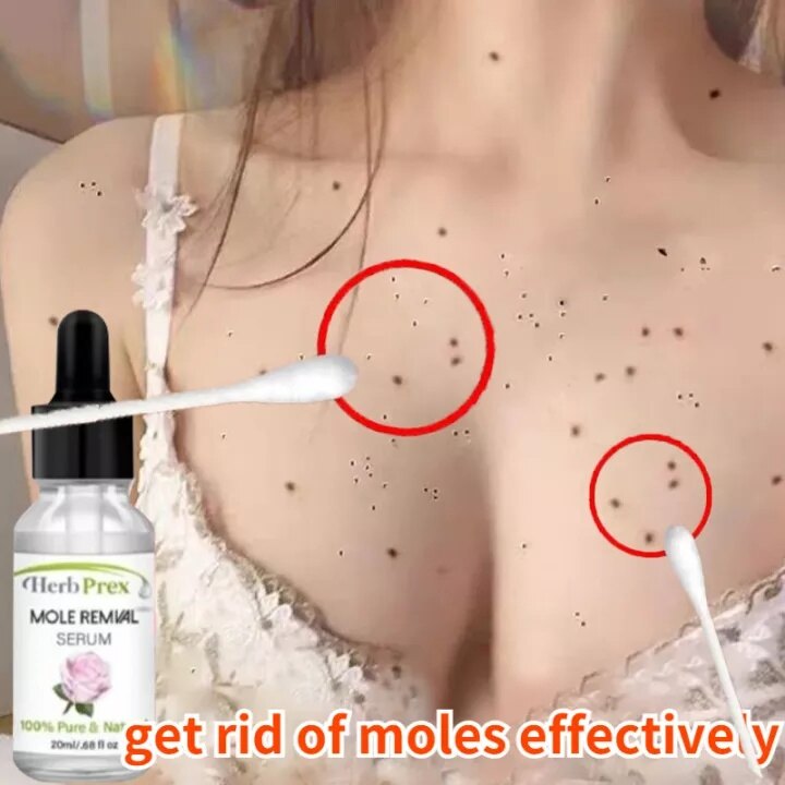 Gambar Rose pure facial essential oil Removes mole freckles and black spots Whitening Dark Spots Blemishes Whitening Moisturizer