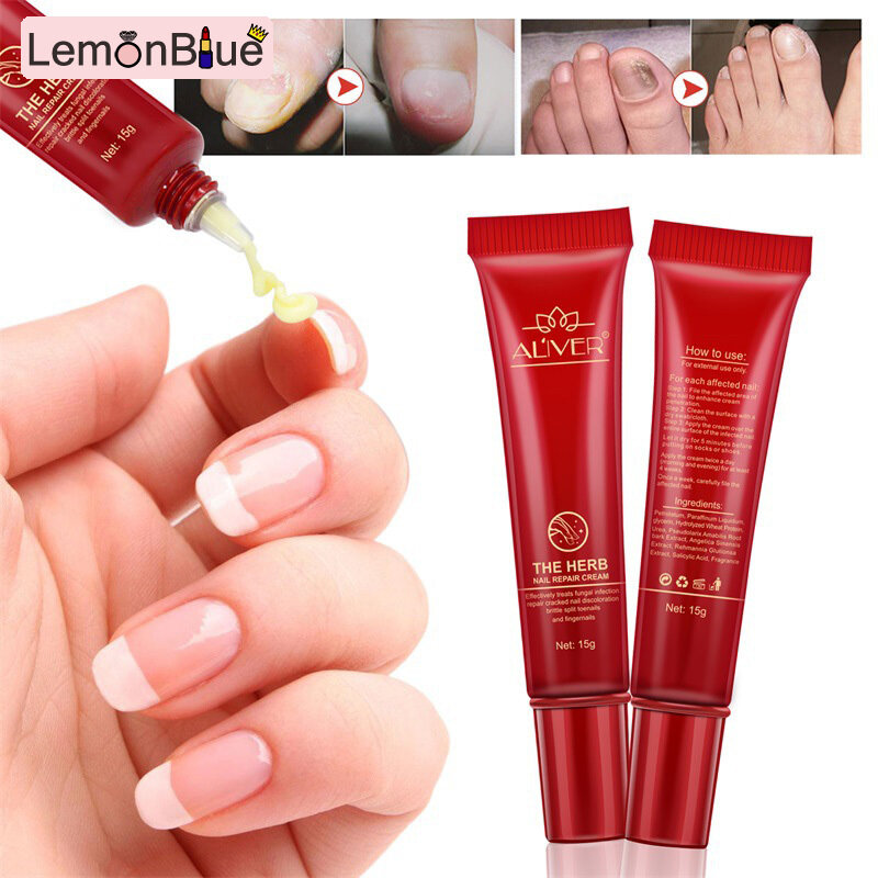 Gambar LemonBlue Nail Repair Cream Nourishing Herb Fingernail Care Treatment Striking Ointment