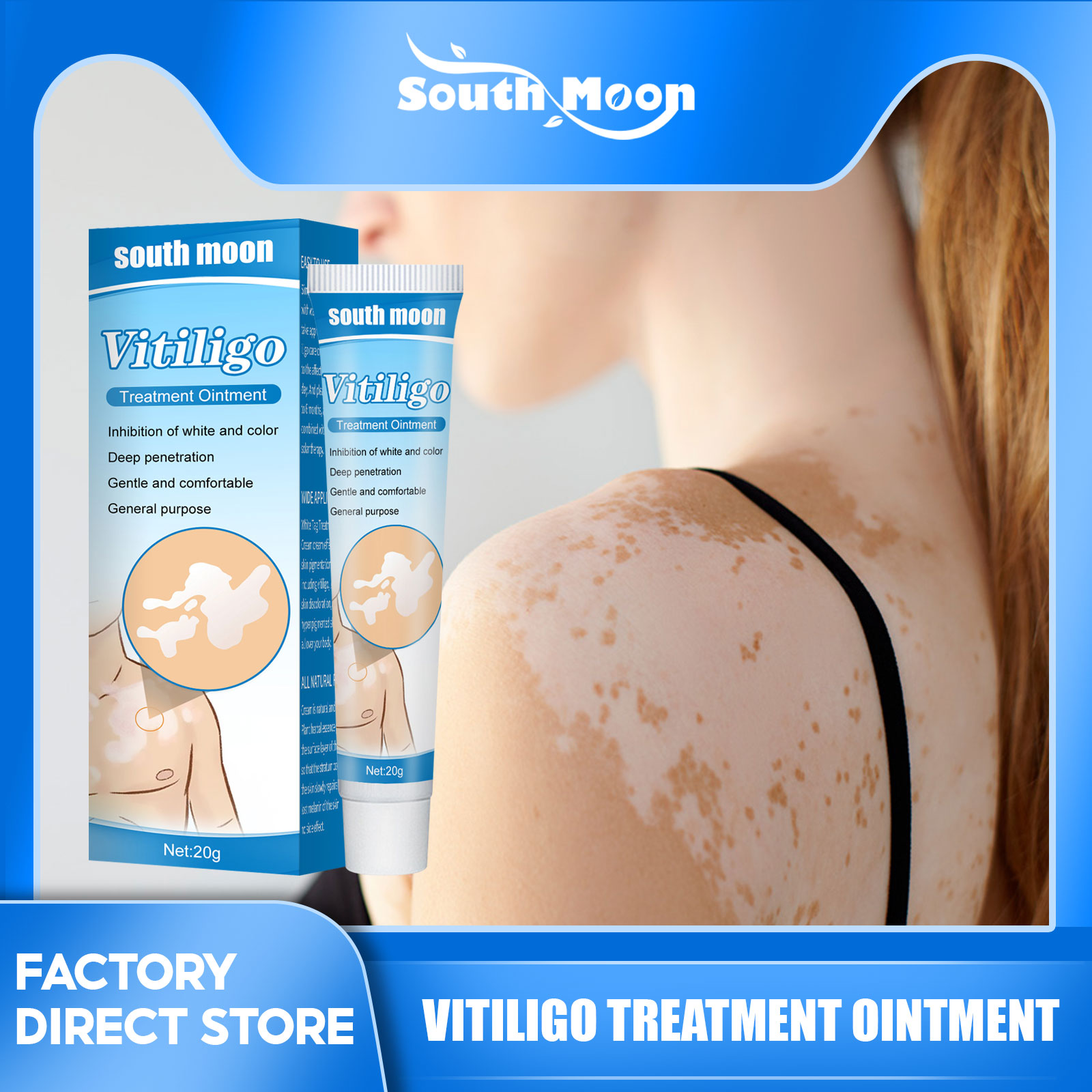 Thuốc mỡ điều trị bạch tạng đốm trắng nam mặt trăng thuốc mỡ vitiligo cục bộ thuốc mỡ điều trị bệnh bạch cầu bạch cầu điều trị viêm bạch cầu