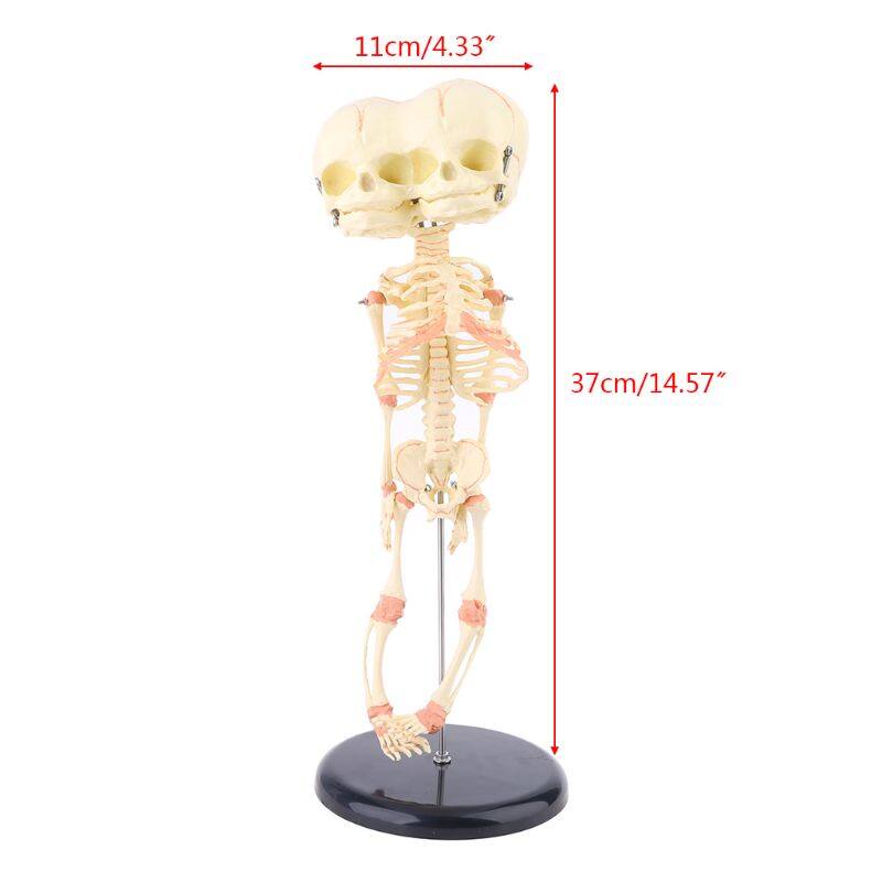 Human Baby Deformed Head Skull Research Model Skeleton Anatomical Brain Anatomy Teaching Display Lazada Singapore