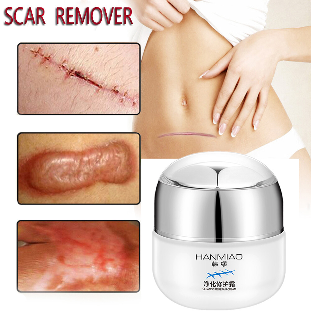 Gambar Scar Removal Cream50g Skin Repair Cream Acne Scar Remove Spots Acne Treatment Blackhead Stretch Marks Whitening Firming Lifting Cream