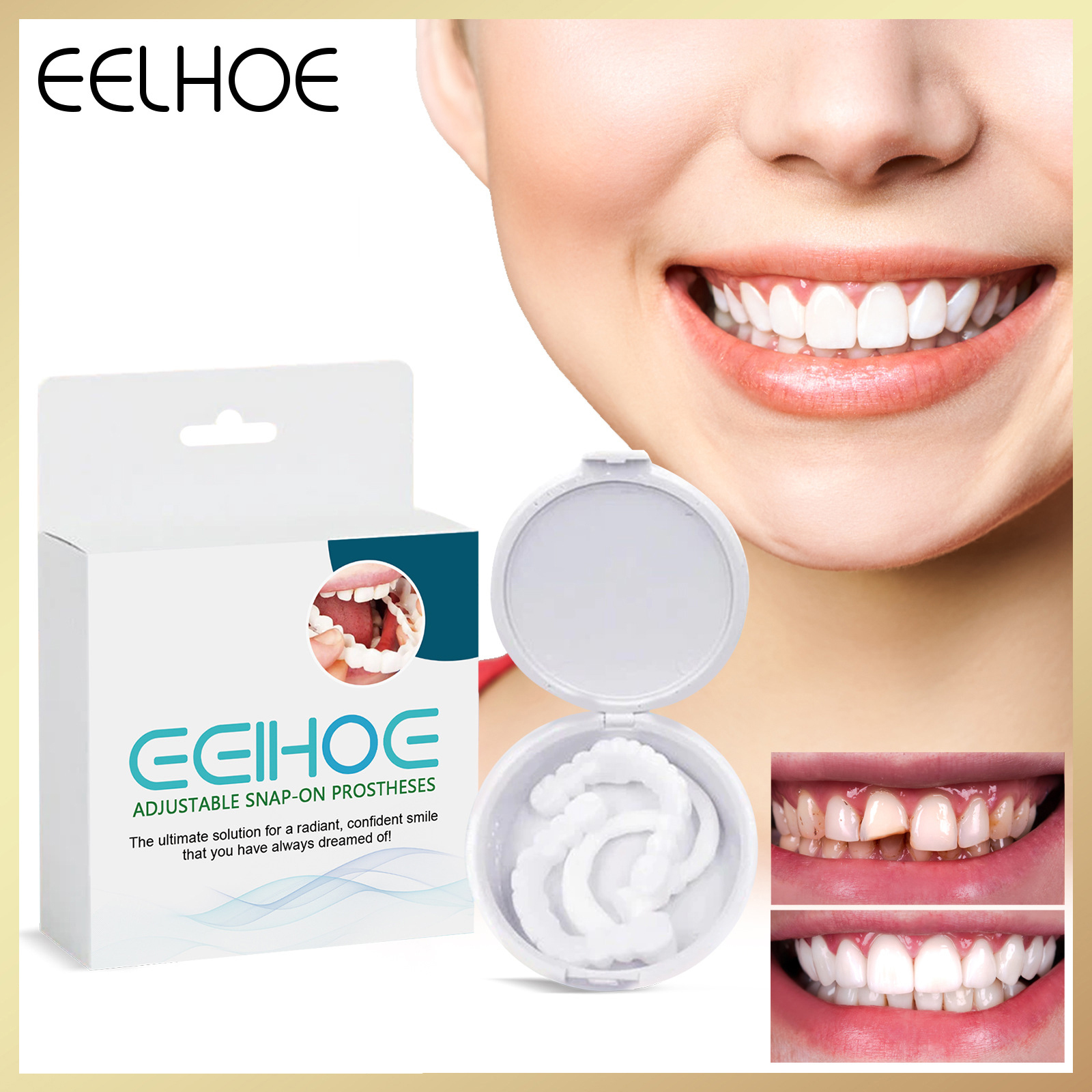Eelhoe răng giả răng giả có thể điều chỉnh snap-on chân giả răng giả silicone phía trên veneer hoàn hảo cười răng giả dán niềng răng thoải mái chỉnh nha niềng răng răng giả dán răng giả tạm thời giả răng giả làm trắng