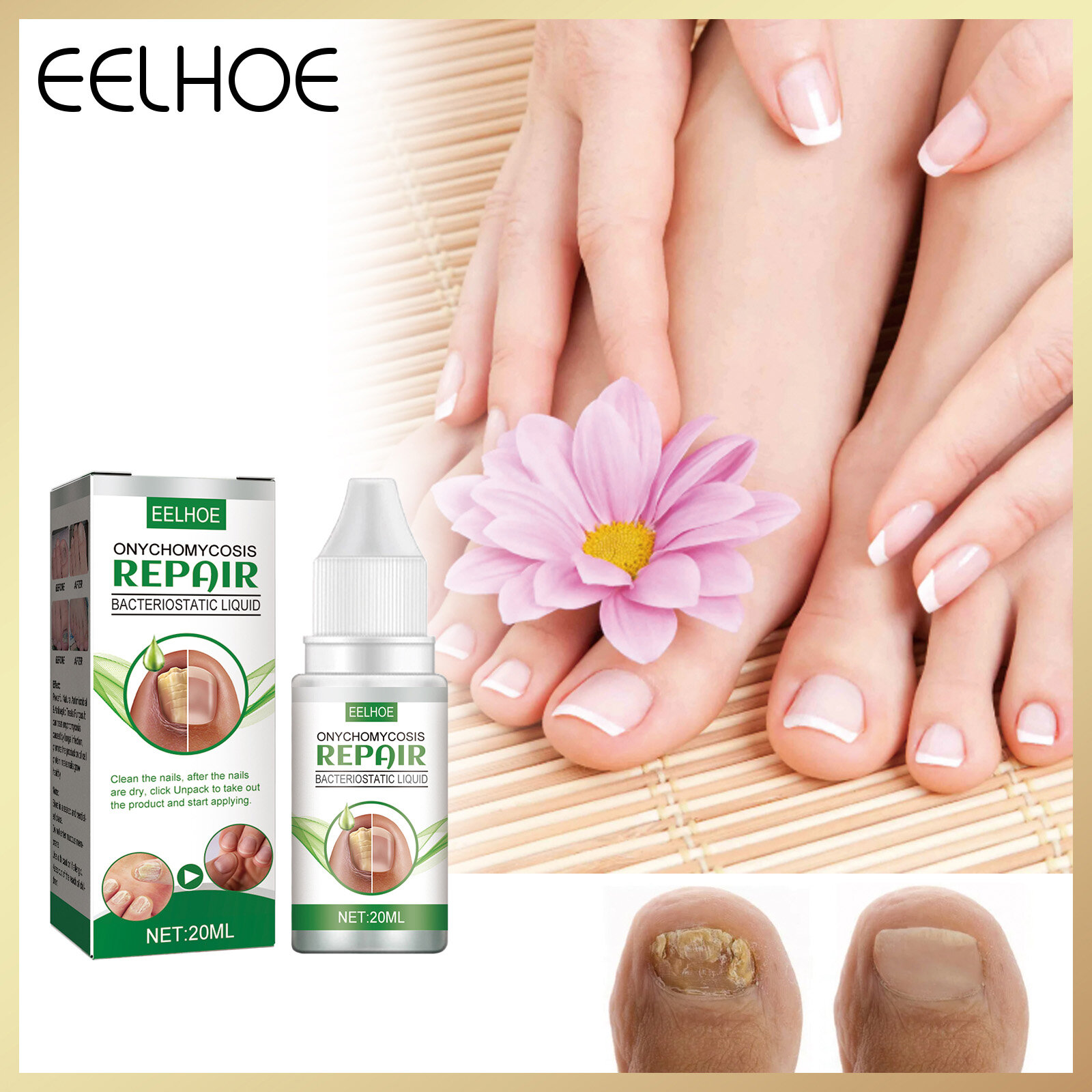 Eelhoe tinh chất kìm khuẩn sửa chữa nấm móng dạng lỏng dung dịch sửa chữa nuôi dưỡng làm sáng móng tay màu xám huyết thanh chăm sóc móng chân dày chống nấm móng chân móng chân móng tay gel loại bỏ nấm ngón chân tay